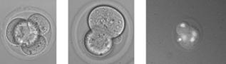 Рис. 1. Лазерное слияние с образованим трехядерных клеток внутри эмбриона.